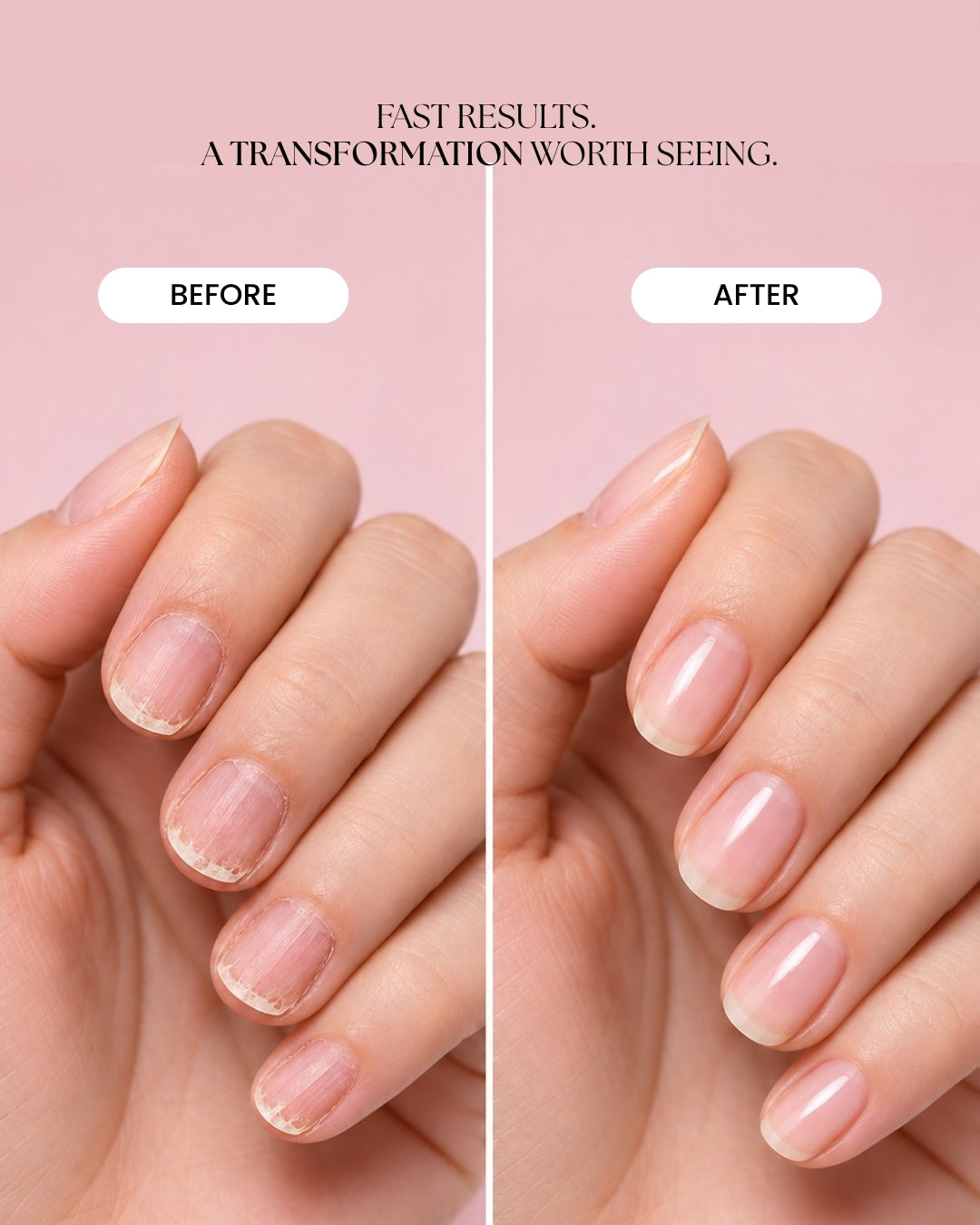 Owna Uriya Nail Serum